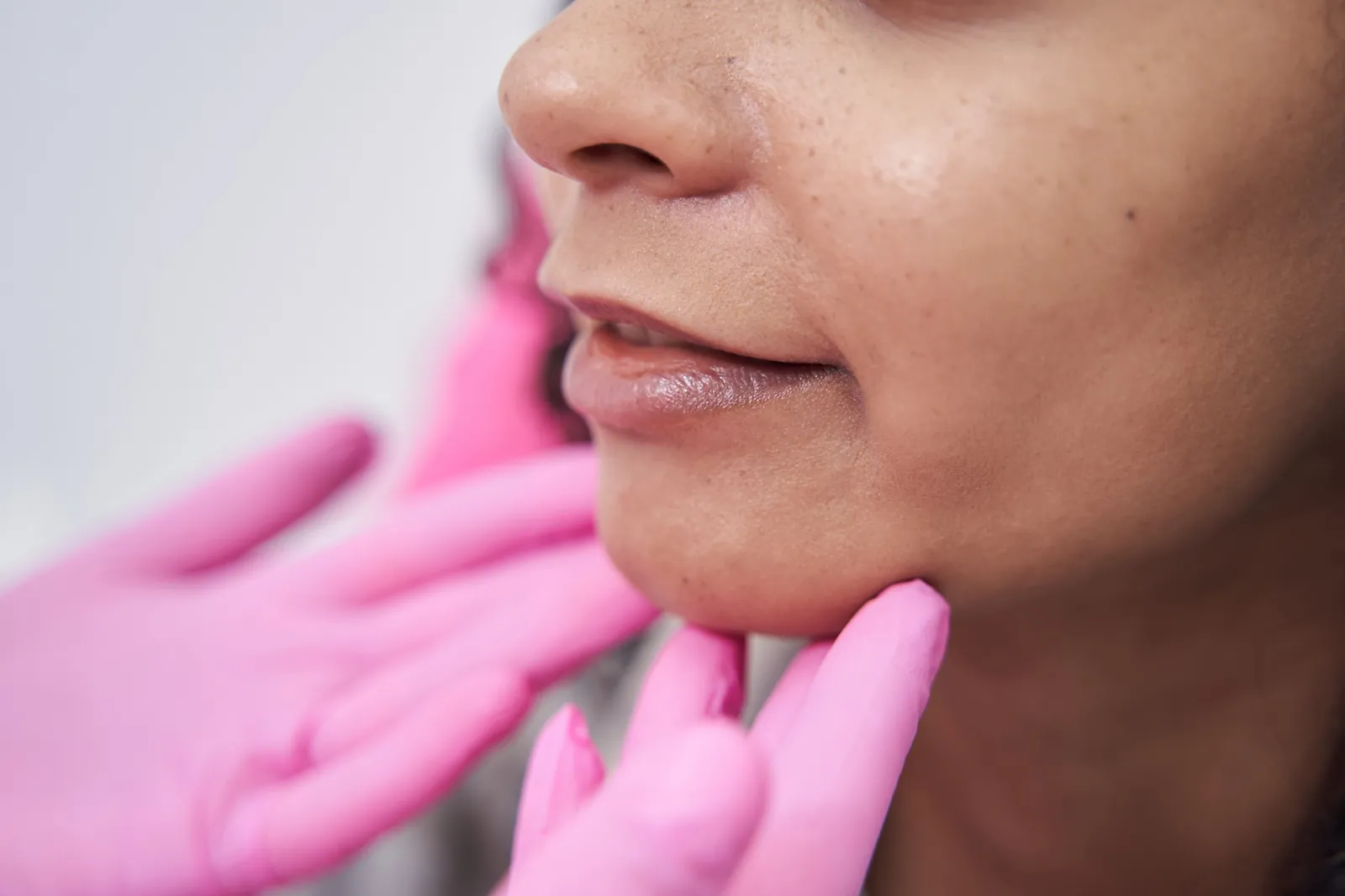 Close-up of a provider's gloved hands examining the jawline and chin of a relaxed patient